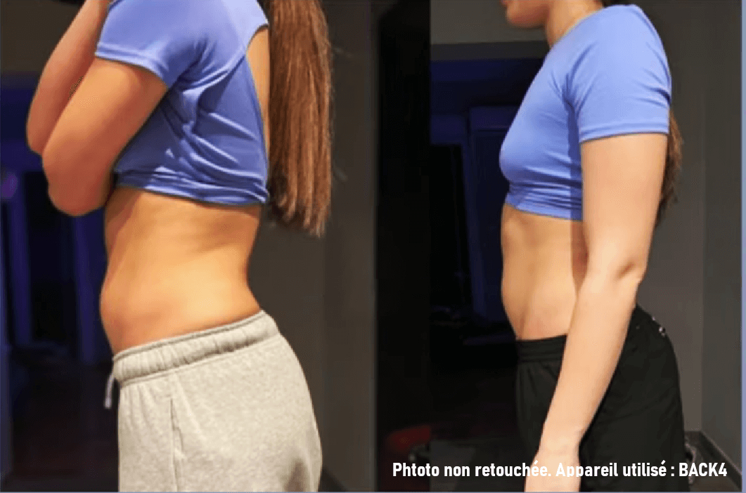 Tecarthérapie Créa'Slim Bretagne